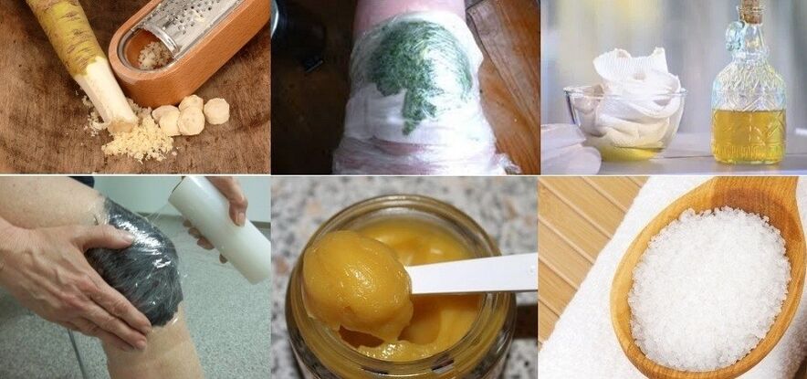 Remedios populares para la artrosis de la articulación de la rodilla.